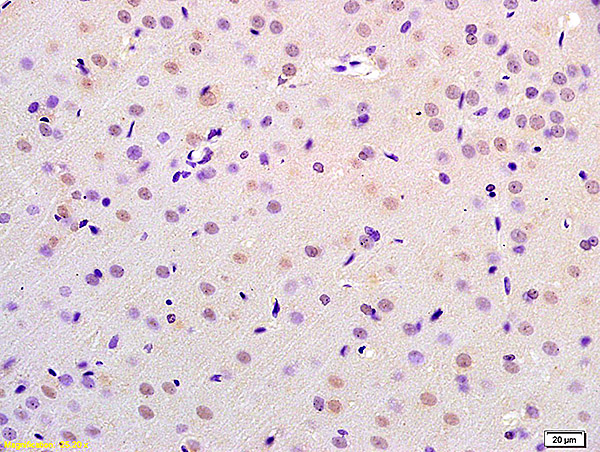 Formalin-fixed and paraffin embedded rat brain labeled with Anti-CHMP4B/CHMP4C Polyclonal Antibody, Unconjugated (bs-7744R) at 1:200 followed by conjugation to the secondary antibody and DAB staining.