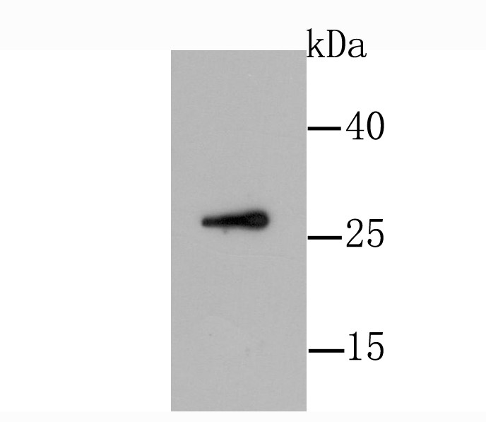 HepG2 cell probed with GDNF (1G8) Monoclonal Antibody (bsm-54018R)at 1:1000 dilution and 4˚C overnight incubation. Followed by conjugated secondary antibody incubation at 1:20000 for 60 min at 37˚C._x000D_