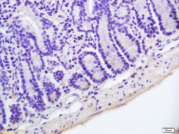 Formalin-fixed and paraffin embedded mouse colon labeled with Anti-Hairless Polyclonal Antibody, Unconjugated (bs-8507R) at 1:200 followed by conjugation to the secondary antibody and DAB staining.
