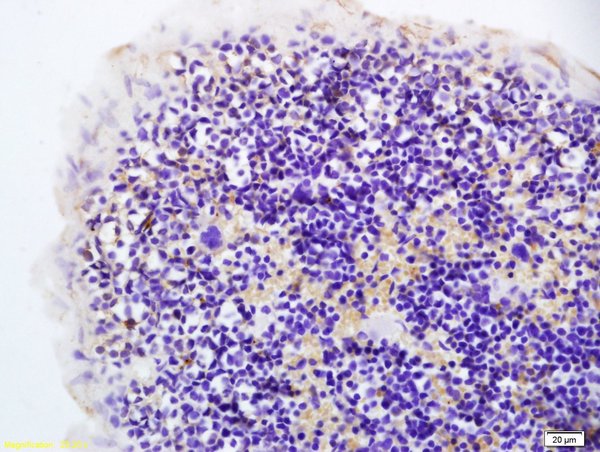 Formalin-fixed and paraffin embedded rat spleen labeled with Anti-Hairless Polyclonal Antibody, Unconjugated (bs-8507R) at 1:200 followed by conjugation to the secondary antibody and DAB staining.