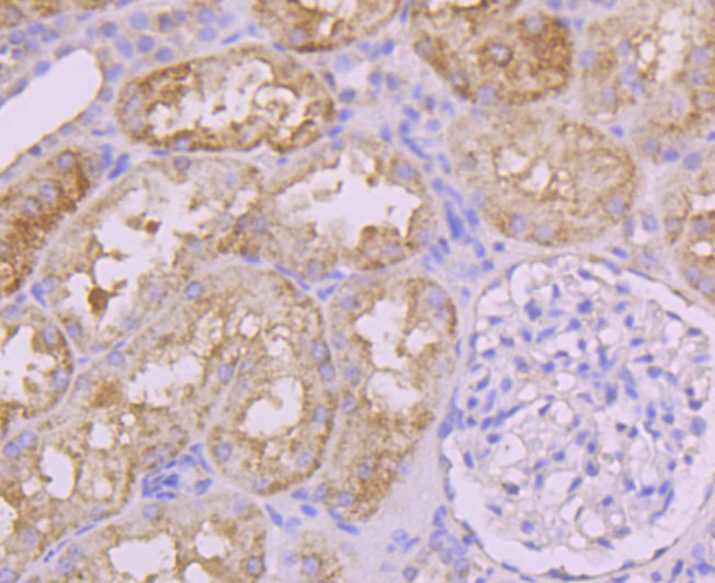 Paraformaldehyde-fixed and paraffin-embedded Human Kidney tissue incubated with Insulin Receptor R (8A1) Monoclonal Antibody (bsm-54080R) at 1:100, overnight at 4°C, followed by a conjugated secondary antibody and DAB staining. Counterstained with hematoxylin.