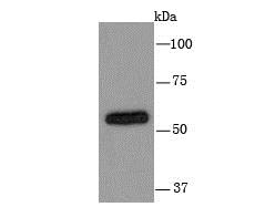 Lane 1: HepG2 Cells; Probed with Cytochrome P450 2D6 (1A7) Monoclonal Antibody (bsm-54084R) at 1:1000 overnight at 4°C followed by a conjugated secondary antibody for 60 minutes at 37°C. Lane 1: HepG2 Cells; Probed with Cytochrome P450 2D6 (1A7) Monoclonal Antibody (bsm-54084R) at 1:1000 overnight at 4°C followed by a conjugated secondary antibody for 60 minutes at 37°C.