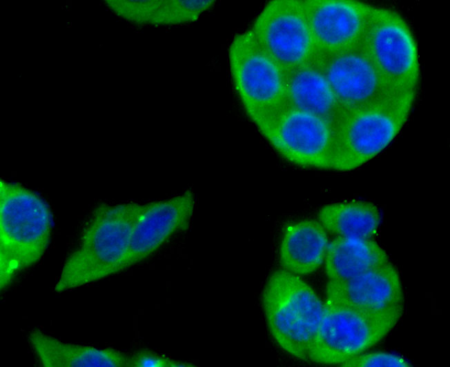 IF(ICC) staining with Cytochrome P450 2D6 (1A7) Monoclonal Antibody (bsm-54084R) at 1:100 in SW480 cells (green). The nuclear counterstain is DAPI (blue). Cells were fixed in paraformaldehyde, permeabilized with 0.25% Triton X100/PBS.