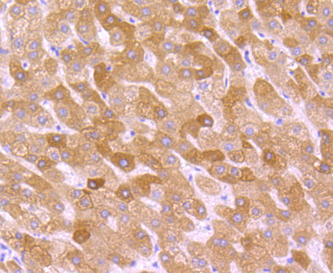 Paraformaldehyde-fixed and paraffin-embedded Human Liver tissue incubated with Cytochrome P450 2D6 (1A7) Monoclonal Antibody (bsm-54084R) at 1:100, overnight at 4°C, followed by a conjugated secondary antibody and DAB staining. Counterstained with hematoxylin.