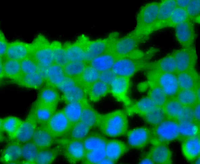 IF(ICC) staining with Protein C (4G10) Monoclonal Antibody (bsm-54086R) at 1:100 in 293T cells (green). The nuclear counterstain is DAPI (blue). Cells were fixed in paraformaldehyde, permeabilized with 0.25% Triton X100/PBS.