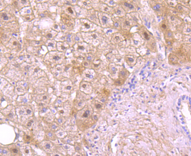 Paraformaldehyde-fixed and paraffin-embedded Human Liver tissue incubated with Protein C (4G10) Monoclonal Antibody (bsm-54086R) at 1:100, overnight at 4°C, followed by a conjugated secondary antibody and DAB staining. Counterstained with hematoxylin.