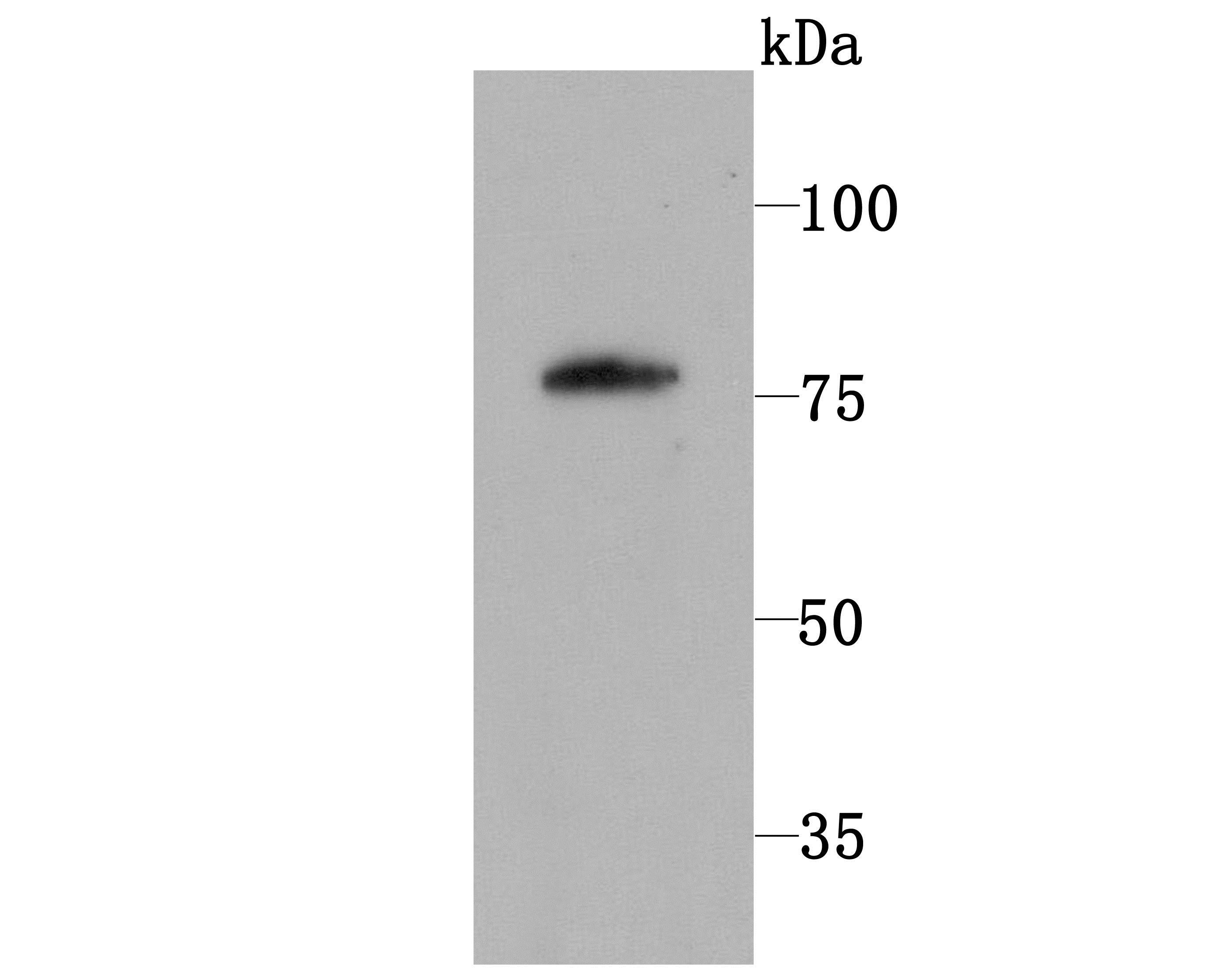 Lane 1: L929 Cells; Probed with PKC beta 1 (1G4) Monoclonal Antibody (bsm-54087R) at 1:1000 overnight at 4°C followed by a conjugated secondary antibody for 60 minutes at 37°C. Lane 1: L929 Cells; Probed with PKC beta 1 (1G4) Monoclonal Antibody (bsm-54087R) at 1:1000 overnight at 4°C followed by a conjugated secondary antibody for 60 minutes at 37°C.