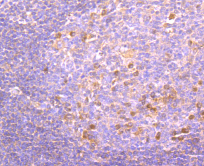 Paraformaldehyde-fixed and paraffin-embedded Human Tonsil tissue incubated with PKC beta 1 (1G4) Monoclonal Antibody (bsm-54087R) at 1:100, overnight at 4°C, followed by a conjugated secondary antibody and DAB staining. Counterstained with hematoxylin.