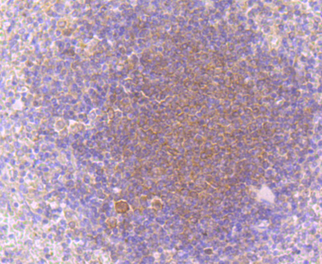 Paraformaldehyde-fixed and paraffin-embedded Human Spleen tissue incubated with PKC beta 1 (1G4) Monoclonal Antibody (bsm-54087R) at 1:100, overnight at 4°C, followed by a conjugated secondary antibody and DAB staining. Counterstained with hematoxylin.