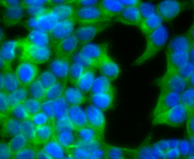 IF(ICC) staining with Ephrin B2 (3A7) Monoclonal Antibody (bsm-54090R) at 1:100 in 293T cells (green). The nuclear counterstain is DAPI (blue). Cells were fixed in paraformaldehyde, permeabilized with 0.25% Triton X100/PBS.