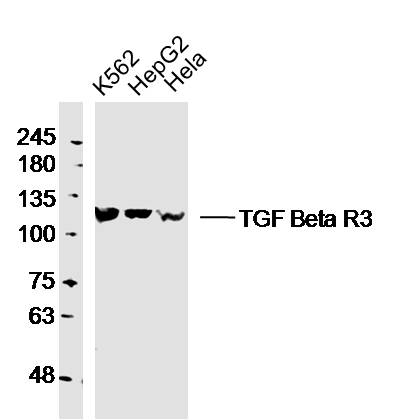 Lane 1: K562 Cells; Lane 2: HepG2 Cells; Lane 3: Hela Cells; Probed with TGF Beta R3 Polyclonal Antibody (bs-1910R) at 1:300 overnight at 4°C followed by a conjugated secondary antibody for 60 minutes at 37°C.