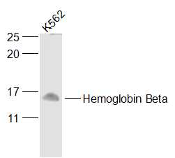 Lane 1: K562 Cells; Probed with Hemoglobin Beta Polyclonal Antibody (bs-8554R) at 1:1000 overnight at 4°C followed by a conjugated secondary antibody for 60 minutes at 37°C.