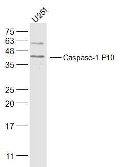 Lane 1: U251 Cells; 30ug loaded into the lane; Probed with Caspase-1 P10 Polyclonal Antibody, Unconjugated (bs-0169R) at 1:500 overnight at 4\u00b0C followed by a conjugated secondary antibody for 60 minutes at 37\u00b0C.