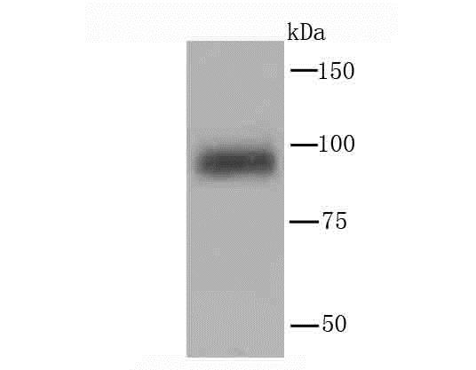 Lane 1: Mouse Spleen; Probed with PI 3 Kinase p110 delta (2A4) Monoclonal Antibody (bsm-54098R) at 1:1000 overnight at 4°C followed by a conjugated secondary antibody for 60 minutes at 37°C.