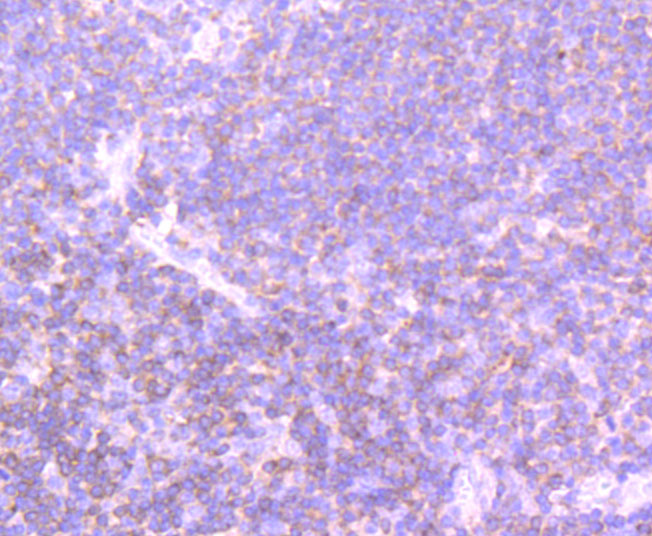 Paraformaldehyde-fixed and paraffin-embedded Human Tonsil tissue incubated with PI 3 Kinase p110 delta (2A4) Monoclonal Antibody (bsm-54098R) at 1:100, overnight at 4°C, followed by a conjugated secondary antibody and DAB staining. Counterstained with hematoxylin.