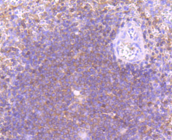 Paraformaldehyde-fixed and paraffin-embedded Human Spleen tissue incubated with PI 3 Kinase p110 delta (2A4) Monoclonal Antibody (bsm-54098R) at 1:100, overnight at 4°C, followed by a conjugated secondary antibody and DAB staining. Counterstained with hematoxylin.