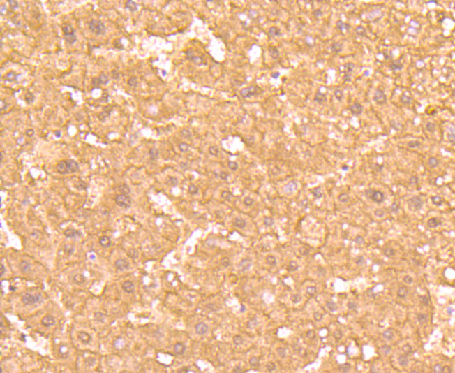 Paraformaldehyde-fixed and paraffin-embedded Human Liver tissue incubated with Ferritin Light Chain (1C8) Monoclonal Antibody (bsm-54107R) at 1:100, overnight at 4°C, followed by a conjugated secondary antibody and DAB staining. Counterstained with hematoxylin.