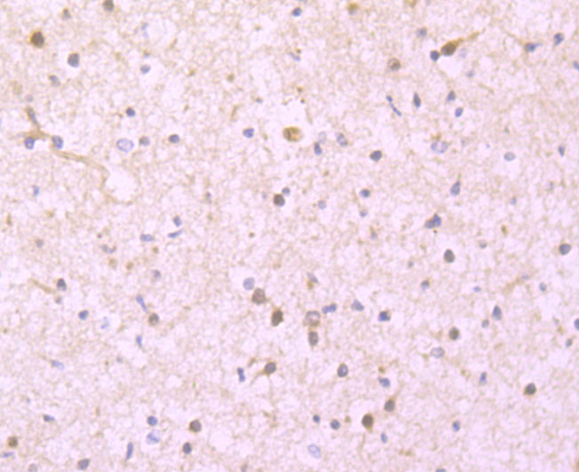 Paraformaldehyde-fixed and paraffin-embedded Human Brain tissue incubated with Ferritin Light Chain (1C8) Monoclonal Antibody (bsm-54107R) at 1:100, overnight at 4°C, followed by a conjugated secondary antibody and DAB staining. Counterstained with hematoxylin.