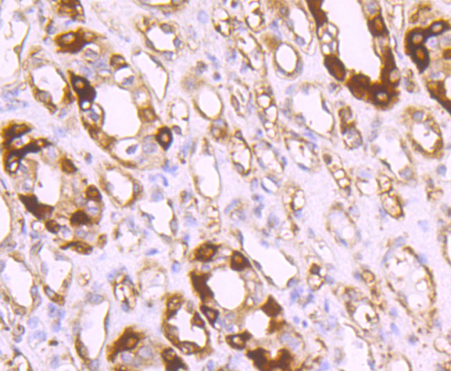 Paraformaldehyde-fixed and paraffin-embedded Human Kidney tissue incubated with Ferritin Light Chain (1C8) Monoclonal Antibody (bsm-54107R) at 1:100, overnight at 4°C, followed by a conjugated secondary antibody and DAB staining. Counterstained with hematoxylin.