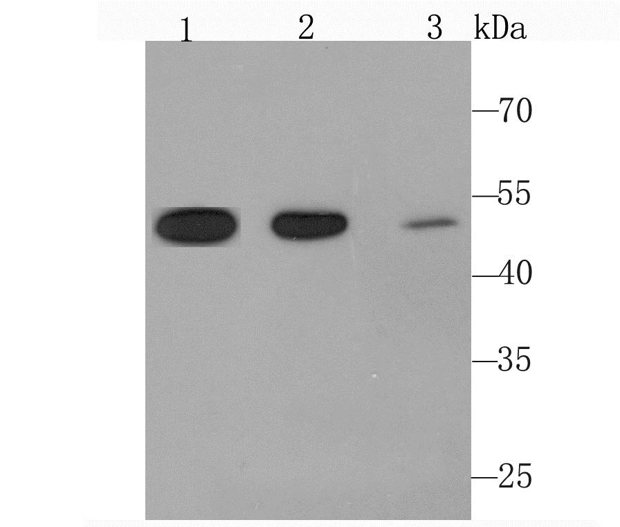 Lane 1: TF-1 Cells; Lane 2: Human Liver; Lane 3: Human Placenta; Probed with Angiopoietin 2 (4G2) Monoclonal Antibody (bsm-54113R) at 1:1000 overnight at 4°C followed by a conjugated secondary antibody for 60 minutes at 37°C. Lane 1: TF-1 Cells; Lane 2: Human Liver; Lane 3: Human Placenta; Probed with Angiopoietin 2 (4G2) Monoclonal Antibody (bsm-54113R) at 1:1000 overnight at 4°C followed by a conjugated secondary antibody for 60 minutes at 37°C.