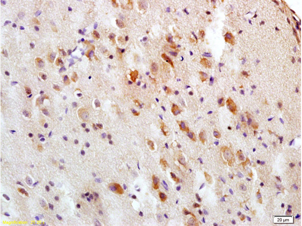 Formalin-fixed and paraffin embedded rat brain tissue labeled with Anti-Tau protein Polyclonal Antibody (bs-0419R), Unconjugated at 1:200, followed by conjugation to the secondary antibody and DAB staining