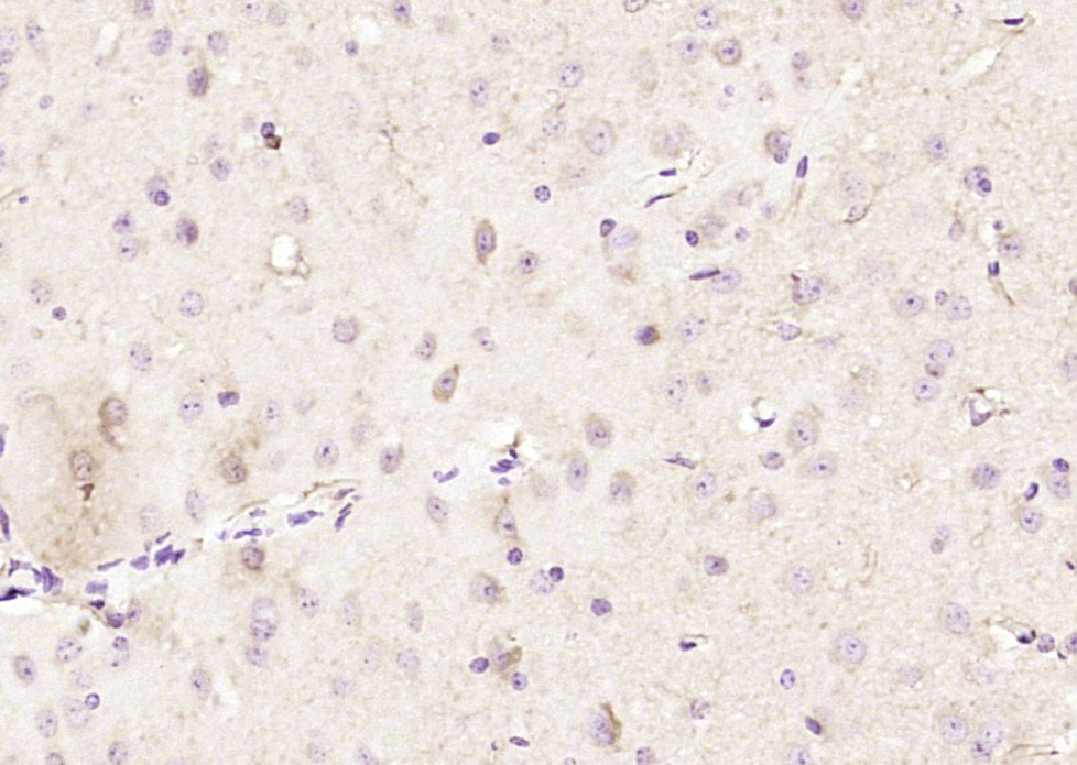 Paraformaldehyde-fixed, paraffin embedded Mouse Brain; Antigen retrieval by boiling in sodium citrate buffer (pH6.0) for 15min; Block endogenous peroxidase by 3% hydrogen peroxide for 20 minutes; Blocking buffer (normal goat serum) at 37°C for 30min; Antibody incubation with ADH5 Polyclonal Antibody, Unconjugated (bs-12448R) at 1:200 overnight at 4°C, followed by secondary antibody DAB and counterstaining.