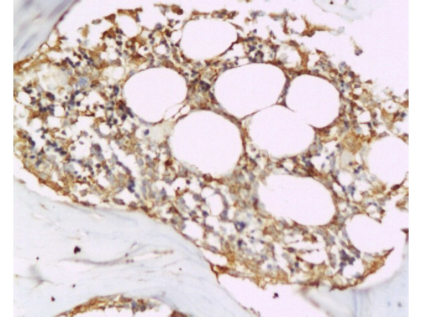 Formalin-fixed and paraffin embedded rat tibia tissue labeled with Anti-Osteoprotegerin Polyclonal Antibody (bs-0431R), Unconjugated at 1:200, followed by conjugation to the secondary antibody and DAB staining