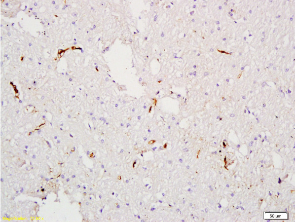 Formalin-fixed and paraffin embedded rat tibia tissue labeled with Anti-Factor VIII (FVIII) Polyclonal Antibody (bs-0434R), Unconjugated at 1:300, followed by conjugation to the secondary antibody and DAB staining