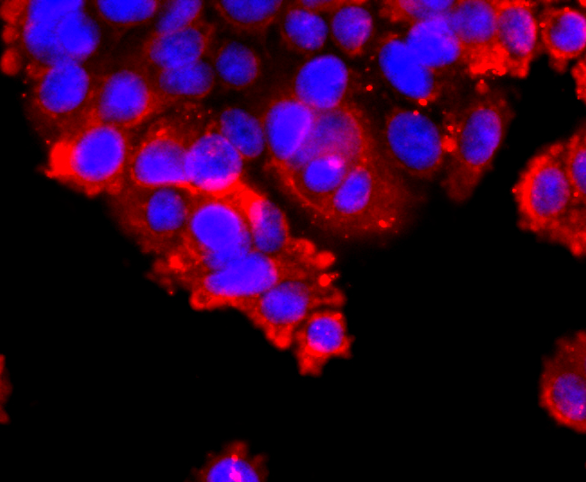 IF(ICC) staining with ADAM17 (9E7) Monoclonal Antibody (bsm-52009R) at 1:100 in SW480 cells (red). The nuclear counterstain is DAPI (blue). Cells were fixed in paraformaldehyde, permeabilized with 0.25% Triton X100\/PBS.
