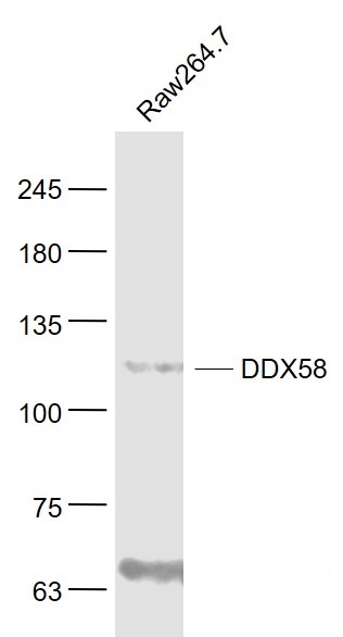 Lane 1: Raw264.7 Cells; Probed with DDX58 Polyclonal Antibody, Unconjugated (bs-0993R) at 1:1000 overnight at 4\u00b0C followed by a conjugated secondary antibody for 60 minutes at 37\u00b0C. The lower band is assumed to be smaller isoform. 