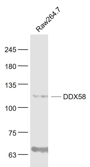 Lane 1: Raw264.7 Cells; Probed with DDX58 Polyclonal Antibody, Unconjugated (bs-0993R) at 1:1000 overnight at 4°C followed by a conjugated secondary antibody for 60 minutes at 37°C. The lower band is assumed to be smaller isoform. Lane 1: Raw264.7 Cells; Probed with DDX58 Polyclonal Antibody, Unconjugated (bs-0993R) at 1:1000 overnight at 4°C followed by a conjugated secondary antibody for 60 minutes at 37°C. The lower band is assumed to be smaller isoform.