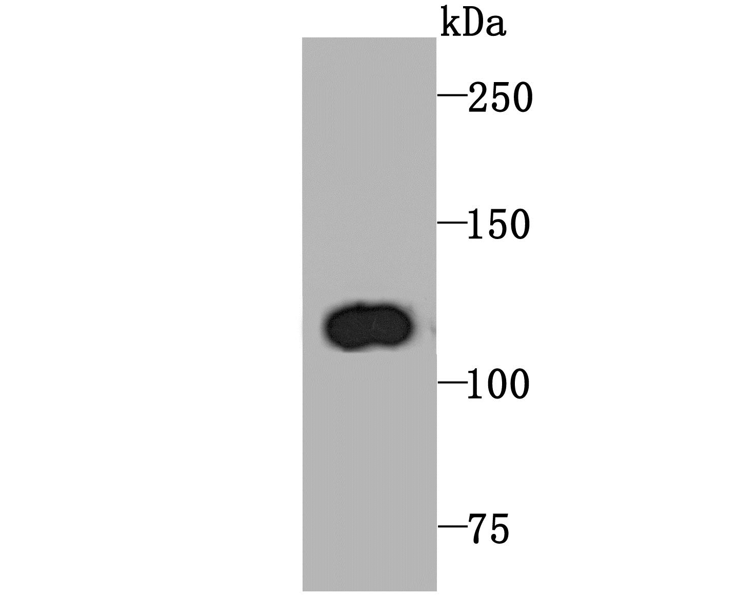Lane 1: Rat Spleen; Probed with PPARG coactivator 1 beta (6H5) Monoclonal Antibody (bsm-54119R) at 1:1000 overnight at 4°C followed by a conjugated secondary antibody for 60 minutes at 37°C. Lane 1: Rat Spleen; Probed with PPARG coactivator 1 beta (6H5) Monoclonal Antibody (bsm-54119R) at 1:1000 overnight at 4°C followed by a conjugated secondary antibody for 60 minutes at 37°C.