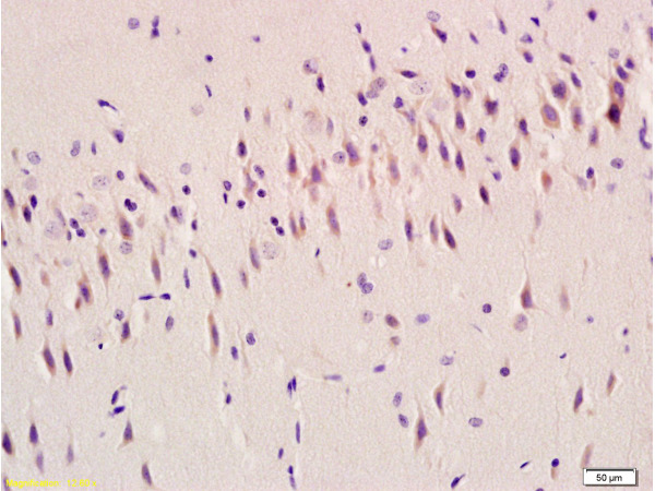 Formalin-fixed and paraffin embedded rat brain tissue labeled with Anti-Ghrelin Polyclonal Antibody (bs-0467R), Unconjugated at 1:100, followed by conjugation to the secondary antibody and DAB staining