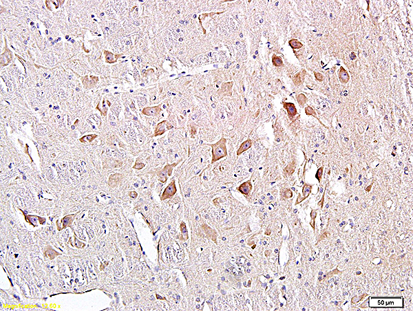 Formalin-fixed and paraffin embedded rat spinal cord labeled with Anti-C-fos Polyclonal Antibody (bs-0469R), Unconjugated at 1:300, followed by conjugation to the secondary antibody and DAB staining
