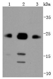 Lane 1: Raji cell ; Lane 2: Jurkat cell; Lane 3: A431 cell; Probed with Bim (42C9) Monoclonal Antibody (bsm-52409R) at 1:1000 overnight at 4°C followed by a conjugated secondary antibody for 60 minutes at 37°C.