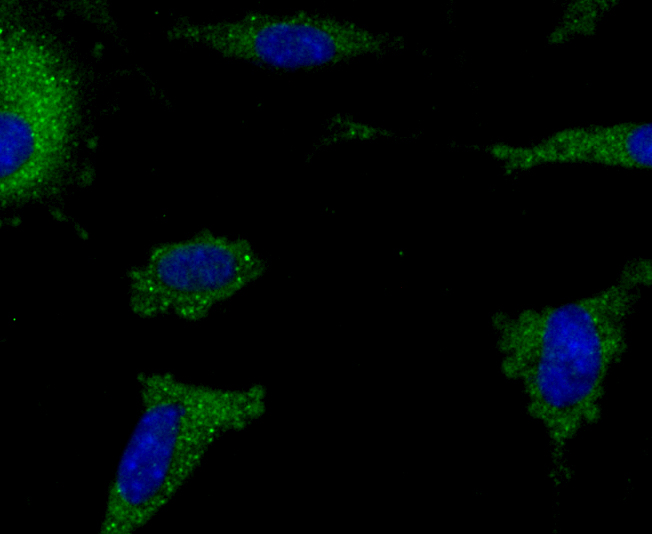 IF(ICC) staining with AIF1 (9A3) Monoclonal Antibody (bsm-54132R) at 1:100 in SH-SY5Y cells (green). The nuclear counterstain is DAPI (blue). Cells were fixed in paraformaldehyde, permeabilized with 0.25% Triton X100/PBS.