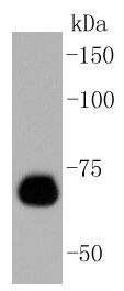 NIH/3T3 cell lysate probed with Caldesmon (14G2) Monoclonal Antibody (bsm-52411R) at 1:1000 overnight at 4°C followed by a conjugated secondary antibody for 60 minutes at 37°C. NIH/3T3 cell lysate probed with Caldesmon (14G2) Monoclonal Antibody (bsm-52411R) at 1:1000 overnight at 4°C followed by a conjugated secondary antibody for 60 minutes at 37°C.