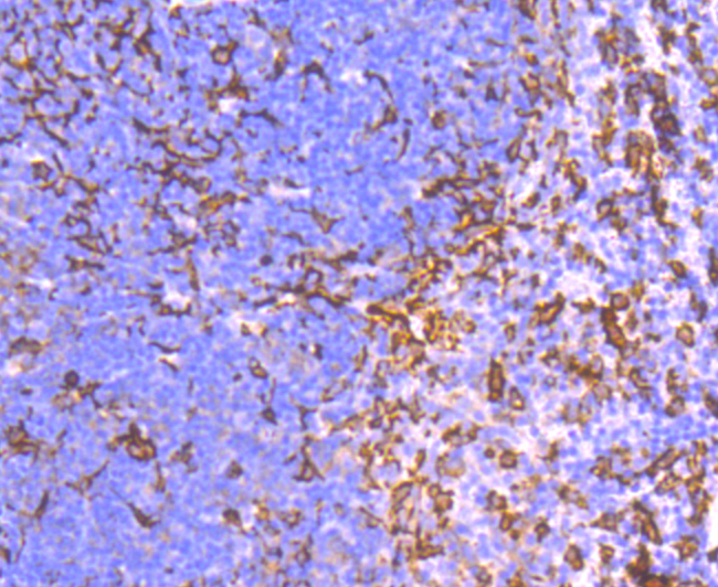 Paraformaldehyde-fixed and paraffin-embedded Mouse Spleen tissue incubated with AIF1 (9A3) Monoclonal Antibody (bsm-54132R) at 1:100, overnight at 4°C, followed by a conjugated secondary antibody and DAB staining. Counterstained with hematoxylin.