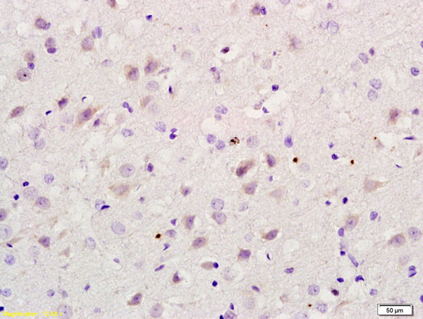 Formalin-fixed and paraffin embedded rat brain labeled with Rabbit Anti RBBP5 Polyclonal Antibody, Unconjugated (bs-6016R) at 1:200 followed by conjugation to the secondary antibody and DAB staining