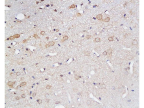 Formalin-fixed and paraffin embedded rat brain tissue labeled with Anti-GLUT1 Polyclonal Antibody (bs-0472R), Unconjugated at 1:200, followed by conjugation to the secondary antibody and DAB staining