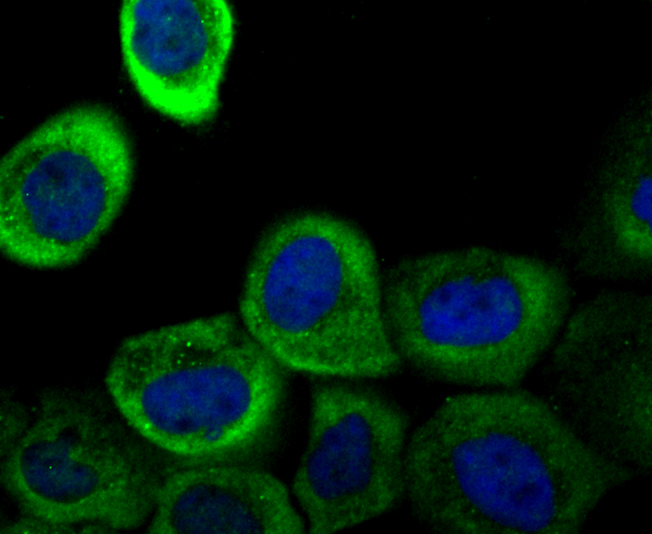 IF(ICC) staining with Galectin 1 (9H8) Monoclonal Antibody (bsm-54137R) at 1:100 in A431 cells (green). The nuclear counterstain is DAPI (blue). Cells were fixed in paraformaldehyde, permeabilized with 0.25% Triton X100/PBS. IF(ICC) staining with Galectin 1 (9H8) Monoclonal Antibody (bsm-54137R) at 1:100 in A431 cells (green). The nuclear counterstain is DAPI (blue). Cells were fixed in paraformaldehyde, permeabilized with 0.25% Triton X100/PBS.