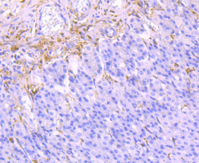 Paraformaldehyde-fixed and paraffin-embedded Rat Stomach tissue incubated with Galectin 1 (9H8) Monoclonal Antibody (bsm-54137R) at 1:300, overnight at 4°C, followed by a conjugated secondary antibody and DAB staining. Counterstained with hematoxylin.
