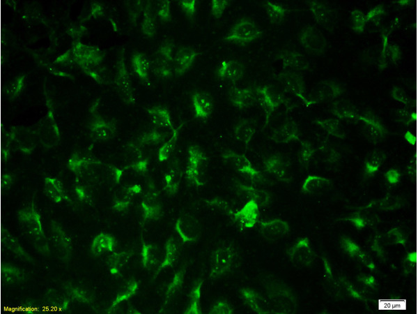 Formalin-fixed: Endothelial cells labeled with Anti-CD31\/PECAM-1 Polyclonal Antibody, Unconjugated (bs-0468R) at 1:200, followed by conjugation to the secondary antibody was Goat Anti-Rabbit IgG, FITC conjugated(bs-0295G-FITC) at 1:200 for 40 minutes at 37\u00b0