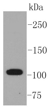 THP-1 cell lysate probed with ABCG1 (8H2) Monoclonal Antibody (bsm-52414R) at 1:1000 overnight at 4°C followed by a conjugated secondary antibody for 60 minutes at 37°C. THP-1 cell lysate probed with ABCG1 (8H2) Monoclonal Antibody (bsm-52414R) at 1:1000 overnight at 4°C followed by a conjugated secondary antibody for 60 minutes at 37°C.