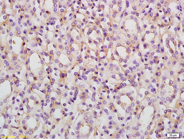 Formalin-fixed and paraffin embedded rat kidney labeled with Rabbit Anti ACVR1B/ALK4 Polyclonal Antibody, Unconjugated (bs-6018R) at 1:200 followed by conjugation to the secondary antibody and DAB staining