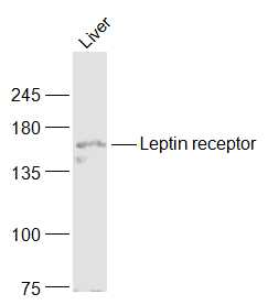 Lane 1: Mouse Liver; Probed with Leptin Receptor Polyclonal Antibody, Unconjugated (bs-0961R) at 1:1000 overnight at 4°C followed by a conjugated secondary antibody for 60 minutes at 37°C.