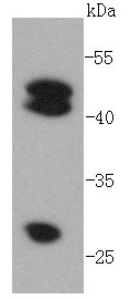 MCF-7 cell Probed with Cathepsin D (2G4) Monoclonal Antibody (bsm-52429R) at 1:1000 overnight at 4°C followed by a conjugated secondary antibody for 60 minutes at 37°C.