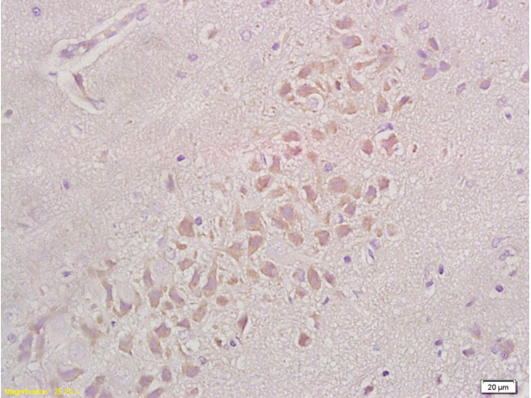 Formalin-fixed and paraffin embedded rat brain tissue labeled with Anti-Integrin beta 1\/CD29 Polyclonal Antibody (bs-0486R), Unconjugated at 1:200, followed by conjugation to the secondary antibody and DAB staining