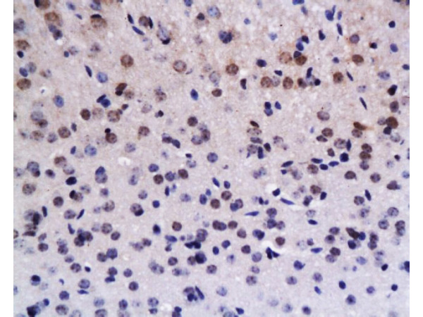 Formalin-fixed and paraffin embedded rat brain tissue  labeled with Anti-Brdu Polyclonal Antibody (bs-0489R), Unconjugated at 1:200, followed by conjugation to the secondary antibody and DAB staining