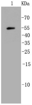 Mouse heart lysate probed with Ubiquitin (7C6) Monoclonal Antibody (bsm-52447R) at 1:1000 overnight at 4°C followed by a conjugated secondary antibody for 60 minutes at 37°C.